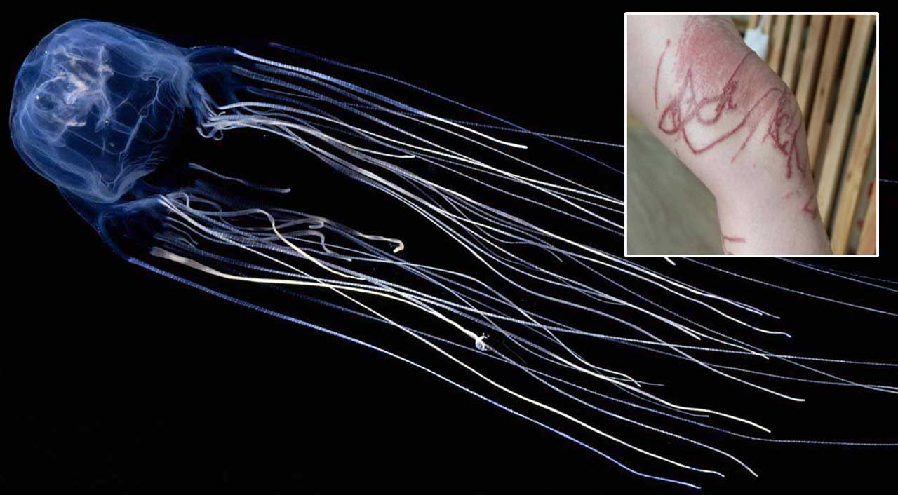 사진 : 방콕 병원 홈페이지